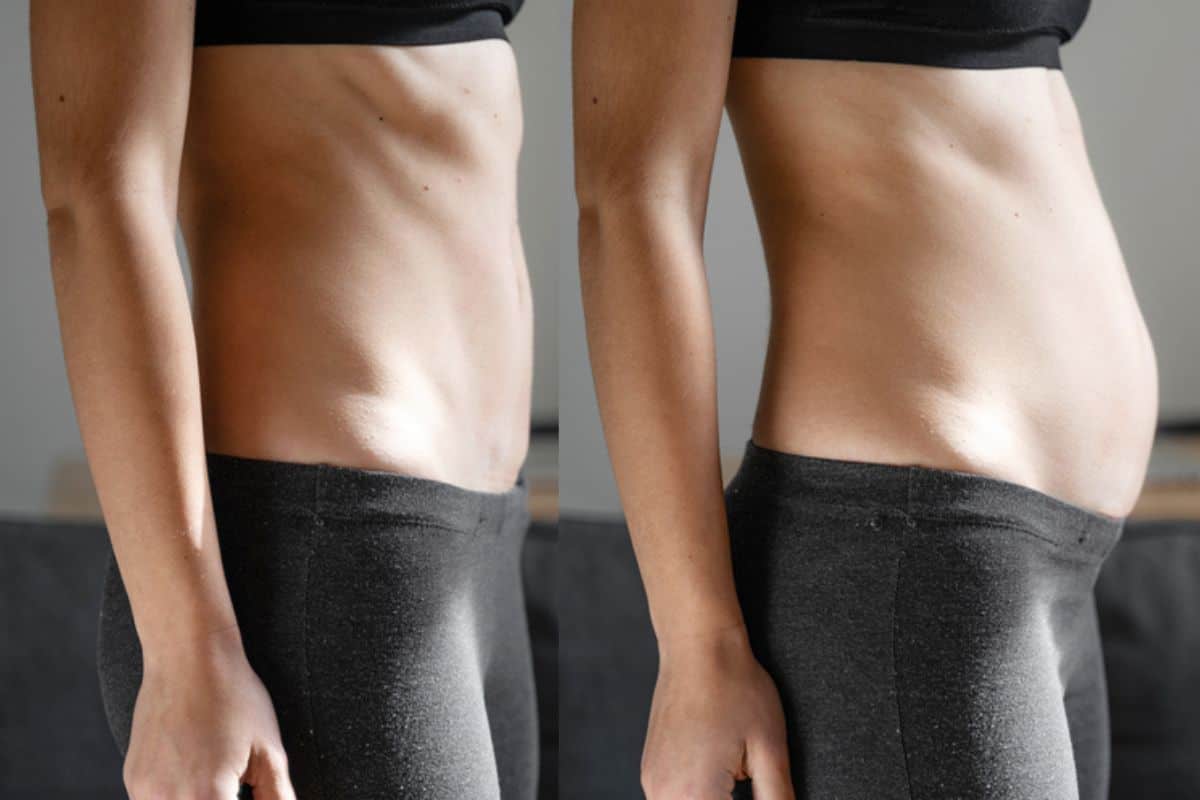 How long does diastasis recti take to improve Hartlepool?