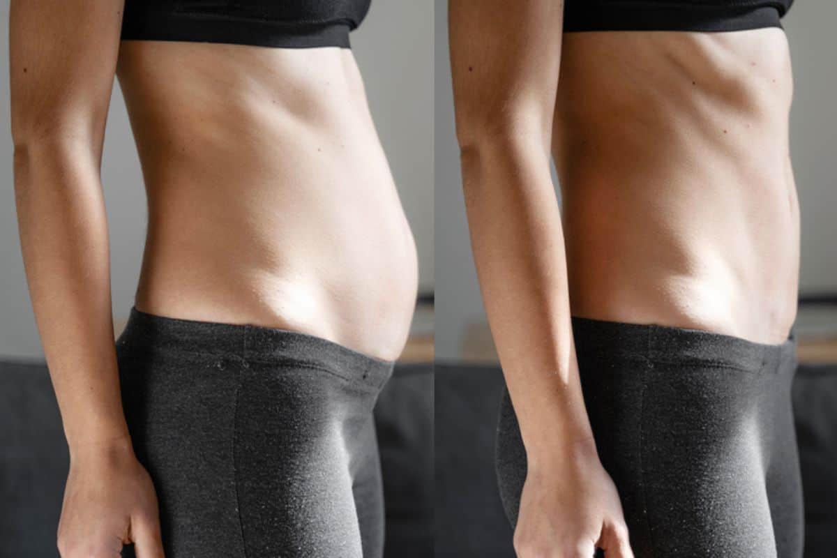 Post-Pregnancy: What Happens to Your Abdominal Muscles After Birth Hartlepool
