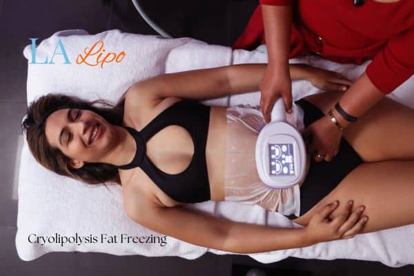 woman getting cryolipolysis Hartlepool