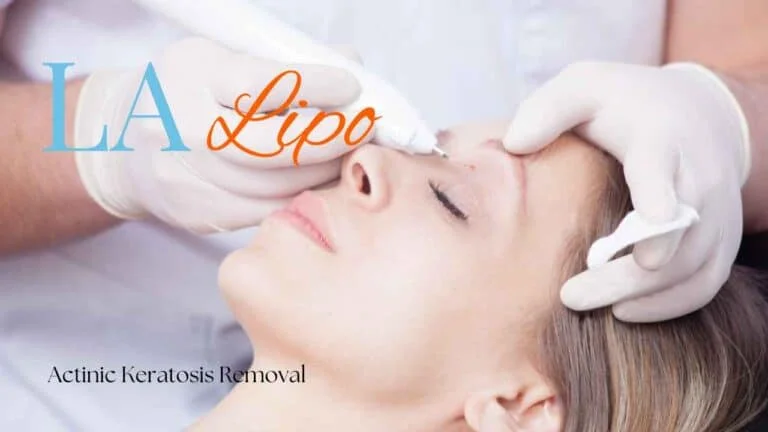 Woman receiving Actinic Keratosis Removal Treatment Hartlepool