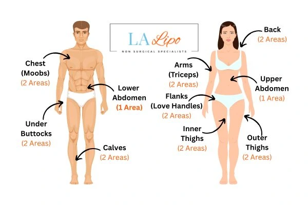 LA LIPO Cryolipolysis Areas Hartlepool