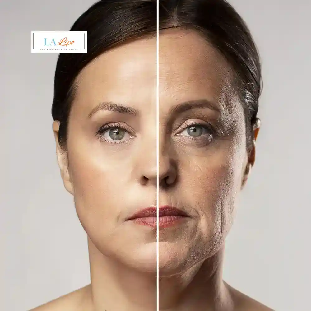 How Can You Tell If Non-Surgical Skin Tightening Is Right for You Hartlepool?