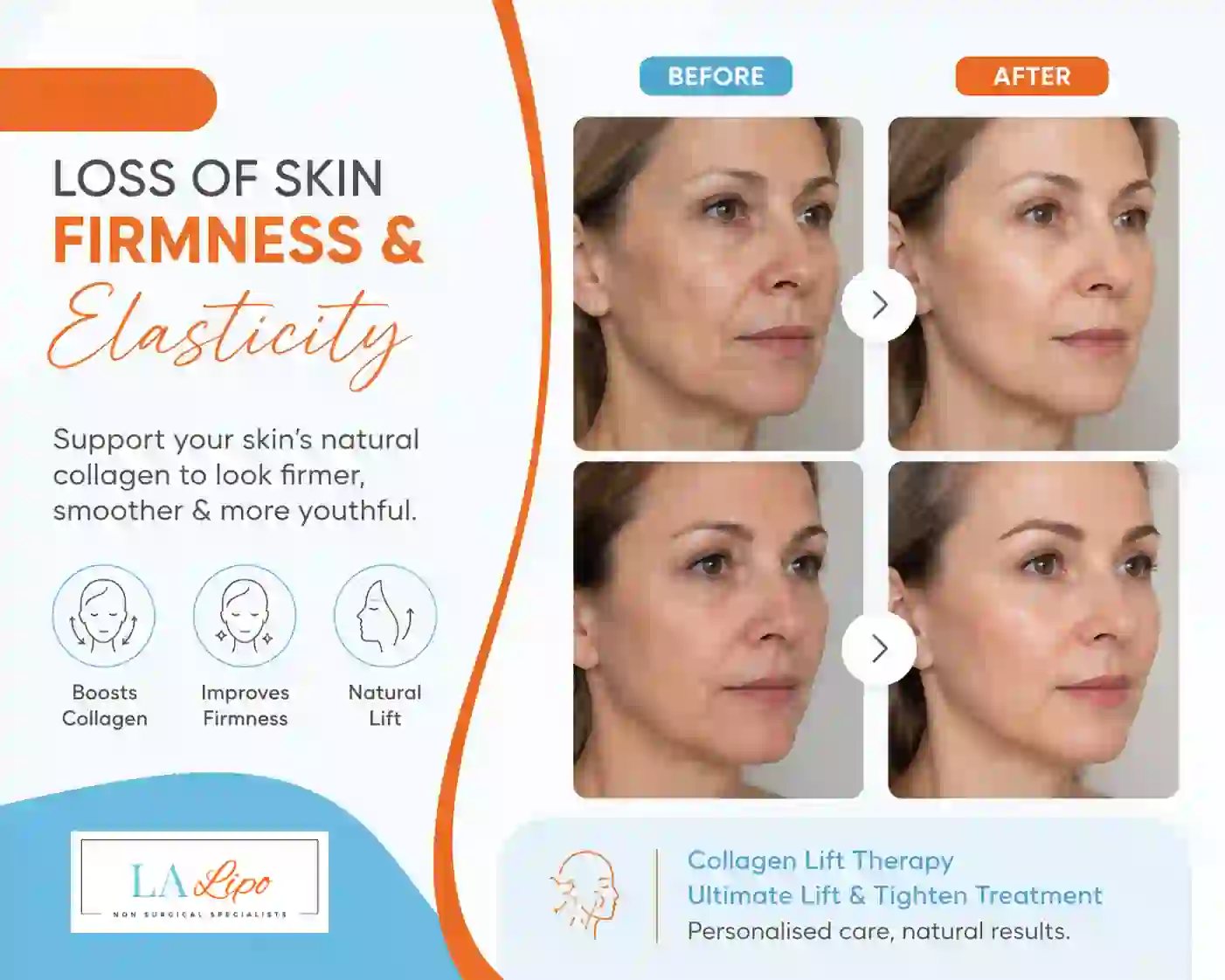 Sign #7: Loss of Skin Firmness and Elasticity Hartlepool