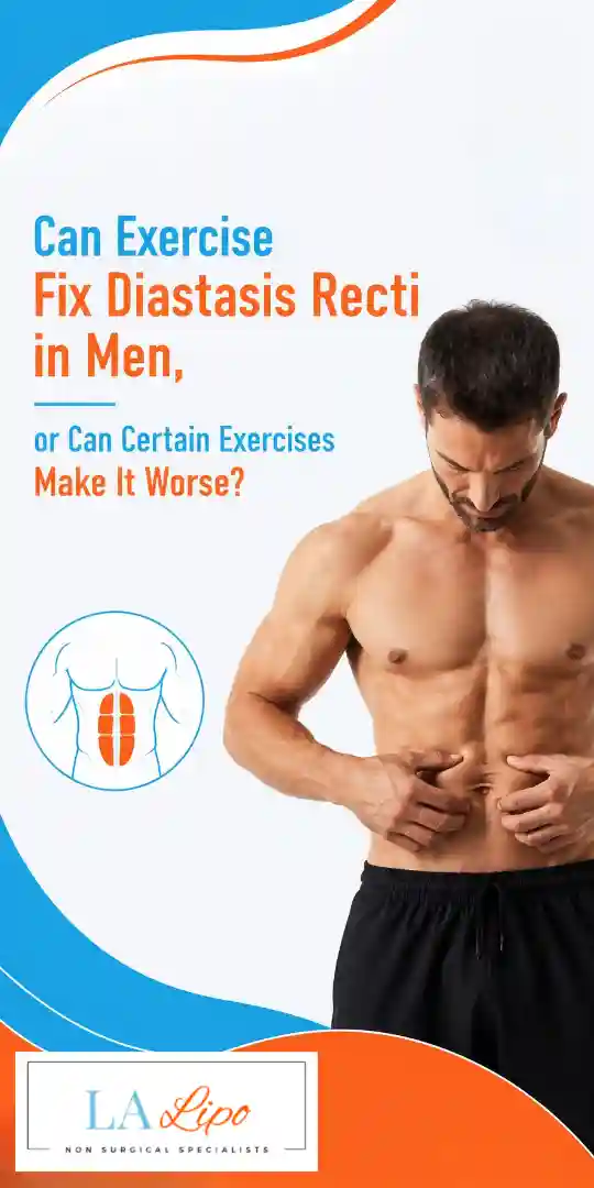 Can Exercise Fix Diastasis Recti in Men, or Can Certain Exercises Make It Worse Hartlepool?
